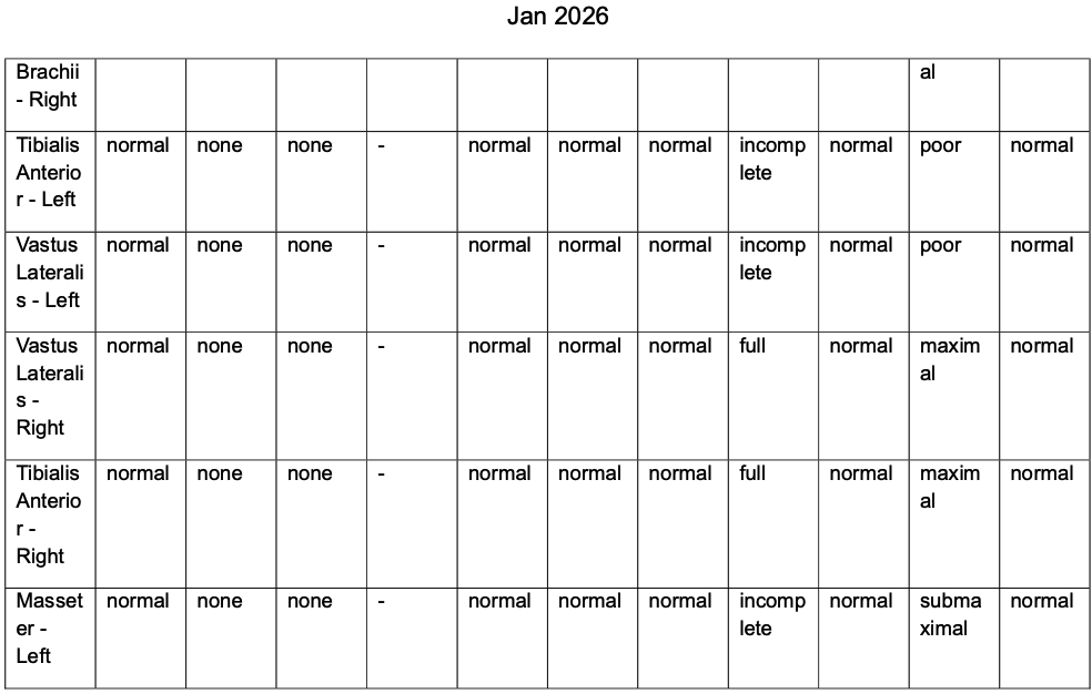 ALS Revised to Primary Lateral Sclerosis — When Electrophysiology Changes Everything