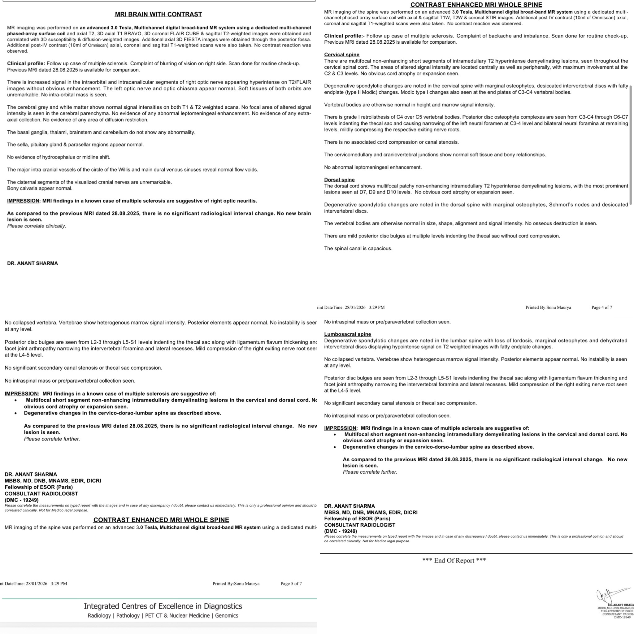 Multiple Sclerosis Misdiagnosed as Guillain-Barré Syndrome: Diagnostic Correction and High-Efficacy DMT Initiation in India