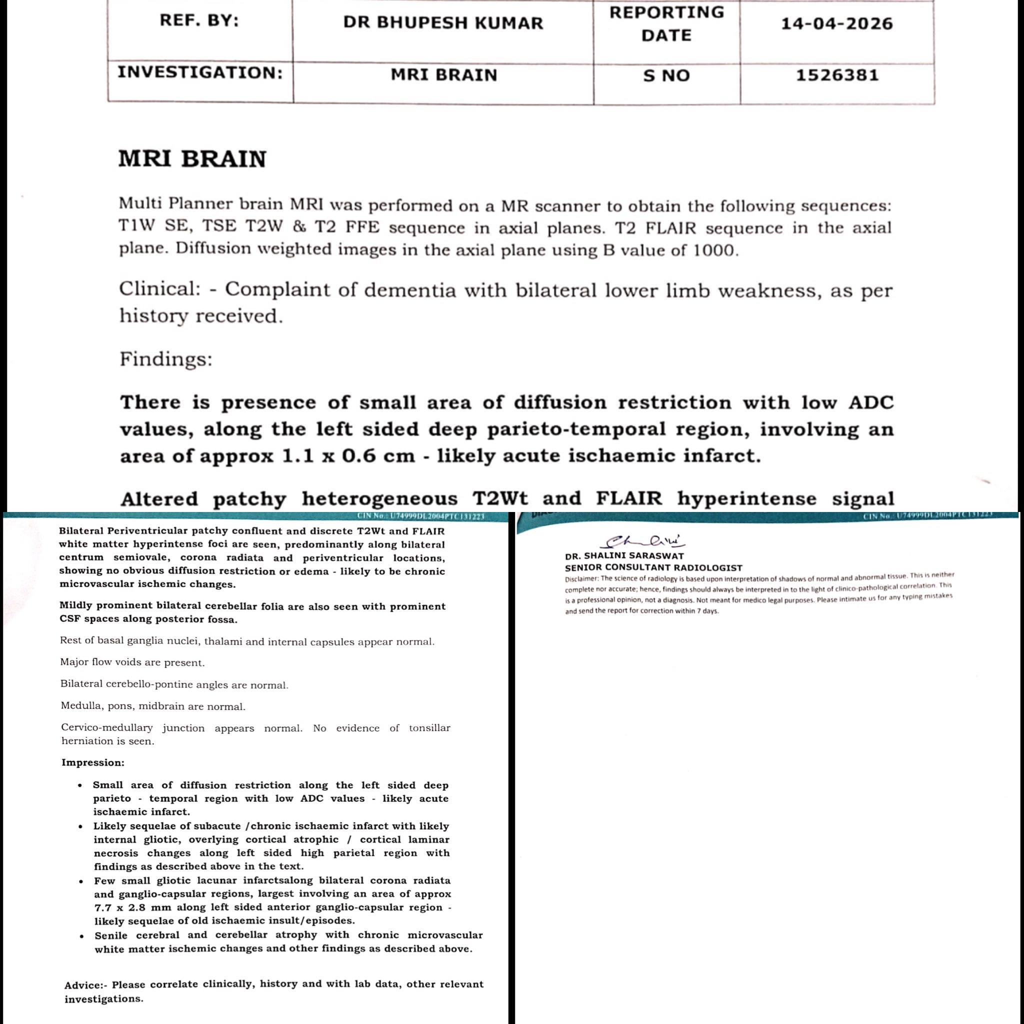 When "Just Forgetfulness" Is a Stroke in Disguise: Acute-on-Chronic Cerebrovascular Disease Presenting as Dementia — clinical image