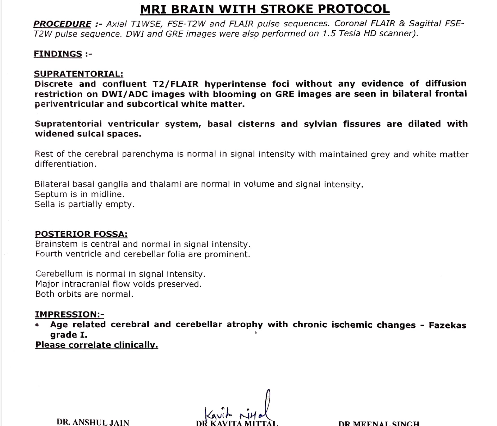 The working diagnosis was new-onset focal seizures with impaired awareness, presenting as a seizure cluster, in an older adult in whom multiple factors had lowered the seizure threshold at once, later confirmed electrographically by overnight EEG.